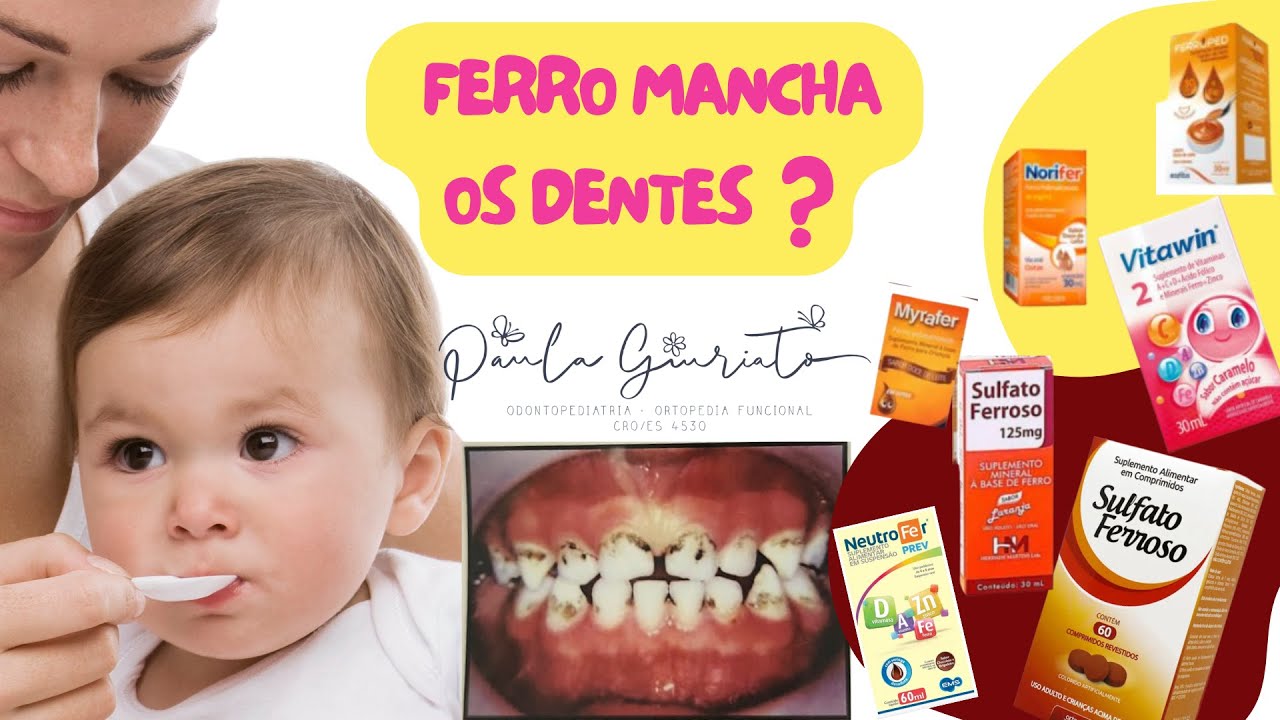 Sulfato ferroso macha os dentes dos bebês? | O que fazer? - YouTube