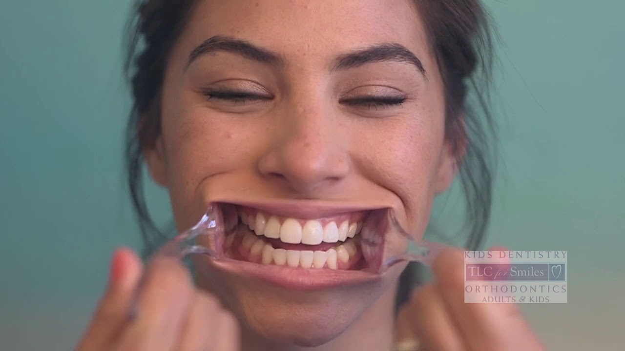 Virtual Consultation