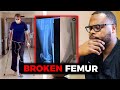 Orthopedic Surgeon Reacts to Tony Hawk's Femur Fracture