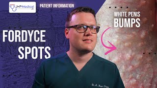Fordyce Spots (Granules) | Yellow or White Lumps on the Penis | Doctor's Review
