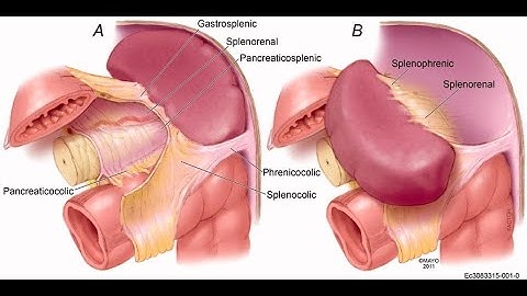 Splenectomy: step-by-step