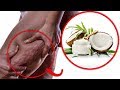 How to get rid of cellulite - 7 Home Remedies for Cellulite Reduction (how to reduce cellulite)
