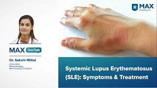 Systemic Lupus Erythematosus (SLE): Symptoms & Treatment | Dr. Sakshi Mittal | Max, Gurugram