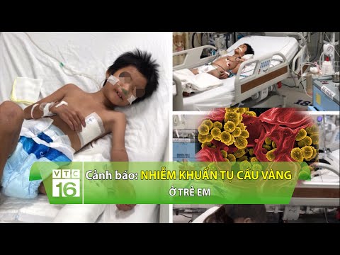 Video: Cách điều Trị Tụ Cầu Vàng ở Trẻ Sơ Sinh