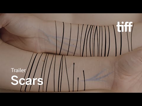 SCARS Trailer | Canada's Top Ten | TIFF 2020