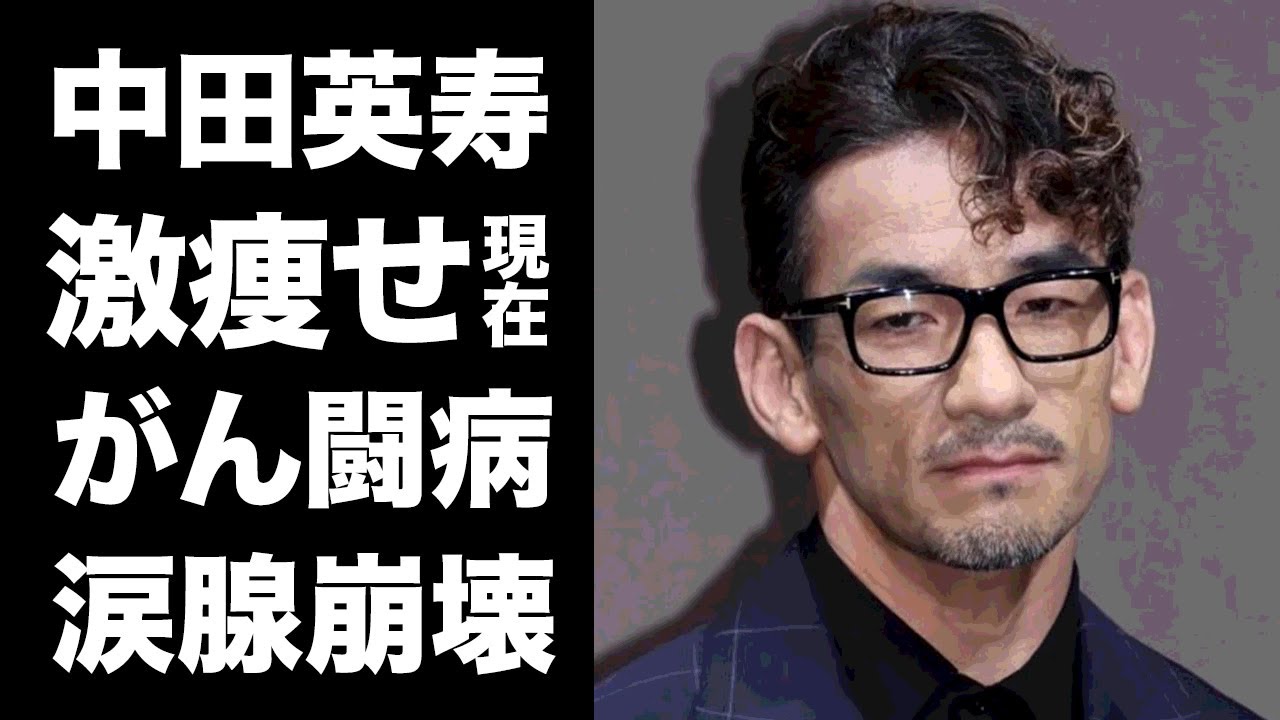中田 英寿 病気