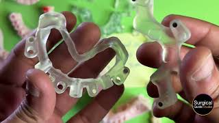 The Stackable Magnetic 🧲 Implant Surgical Guide - Case ID: Z abfz