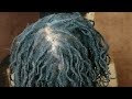 A CANCER SURVIVOR AND HER AMAZING LOC JOURNEY