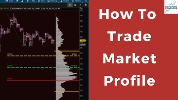 Learn How To ( Trade Market Profile Chart & Patterns )