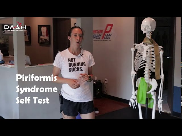 Piriformis Syndrome Self Test