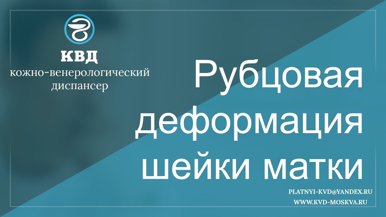 645 Рубцовая деформация шейки матки