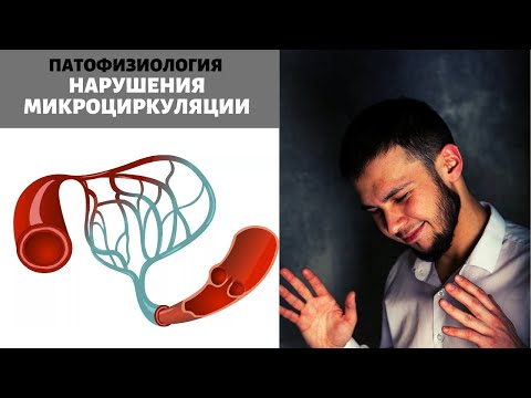 Нарушения микроциркуляции