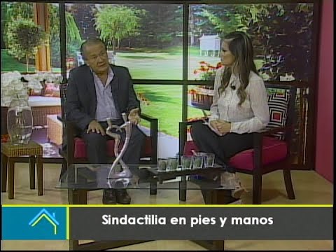 Estética al Día: Sindactilia en pies y manos