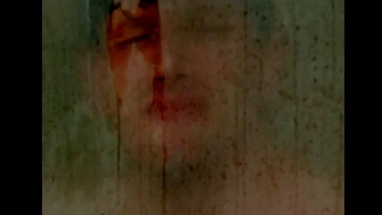 Bruises - David Adison