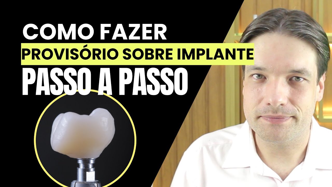 Como fazer provisório sobre implante: passo a passo