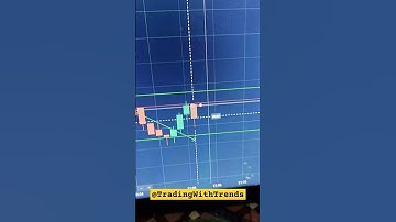 #binarytrading #traders #binaryoptions Trader videos #tradingshorts #trading #tradingwithtrends