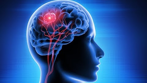 Brain Tumor Detection using MRI Scanned Images