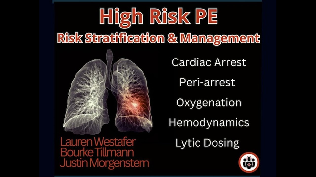 Ep 204 High Risk Pulmonary Embolism Management
