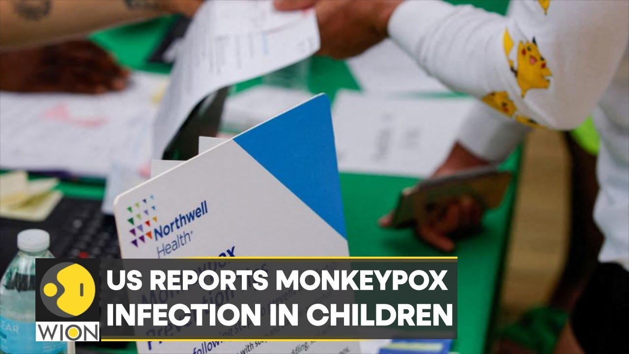 US: Monkeypox confirmed in children for the first time | World Latest English News | WION