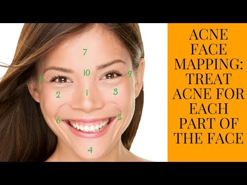 Acne :Chinese Style Acne Face Mapping for getting rid of acne overnight|take care of acne at home