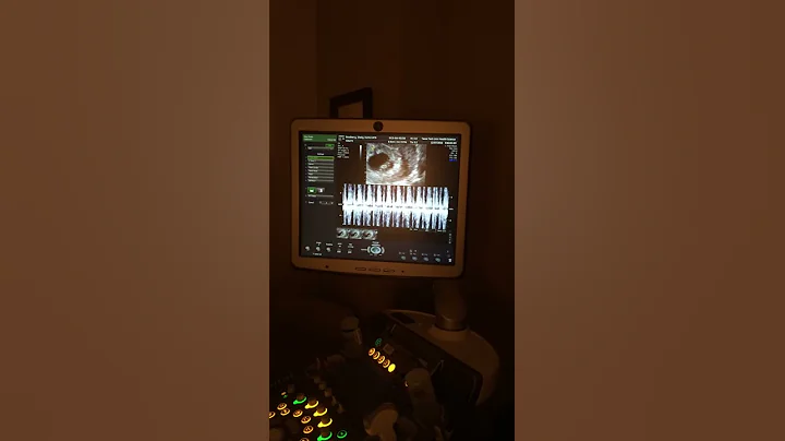 9 weeks