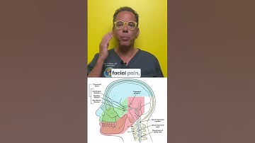 What causes trigeminal neuralgia and nerve dysfunction headaches? #facialpain #headpressure