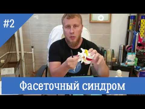 Фасеточный синдром. "фасет-синдром"