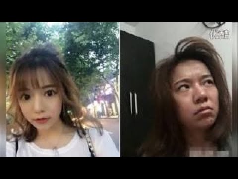 韩国整形手术前后 韩国有名整形医院惊叹的变化 Let美人指定医院 Youtube