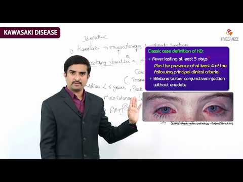 Videó: A mucocutan nyirokcsomó-szindróma betegség?