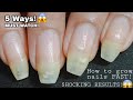 How to grow nails FAST &amp; LONG at Home! 😱 | 5 Best Ways to grow Nails FASTER! Tips to grow nails fast