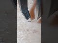 チャンネル登録者様２００人ありがとう🥰#毛抜き動画 #毛抜き #tweezer #埋没毛 #plucking #blackheads #extraction #角栓 #脇毛 #髭抜き