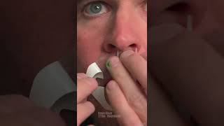 Why pay an ER co-pay when you can just zip-tie your face shut? 🤐