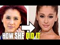 Ariana Grande: Plastic Surgery Ariana Grande Had (2020)