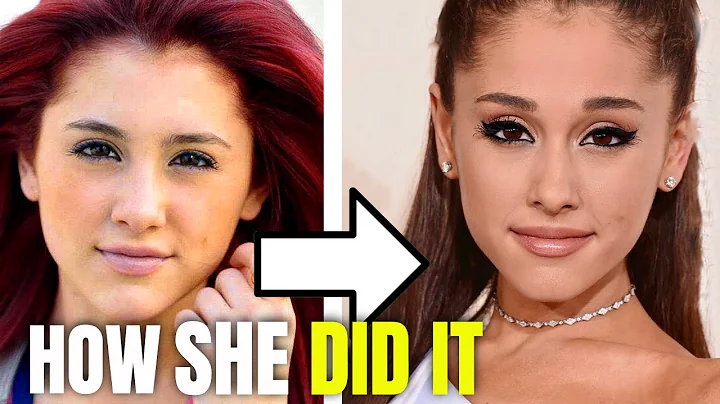 Ariana Grande: Plastic Surgery Ariana Grande Had (2020)