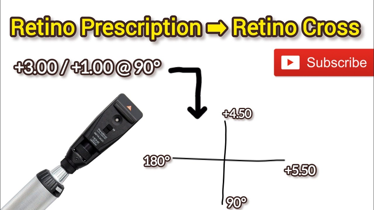 How to Convert Retinoscopy Findings to Retinoscopic Cross | Easy Guide for Optometry Students