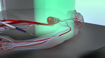 Bernhard Gleich, Jürgen Weizenecker et leur équipe (Allemagne)