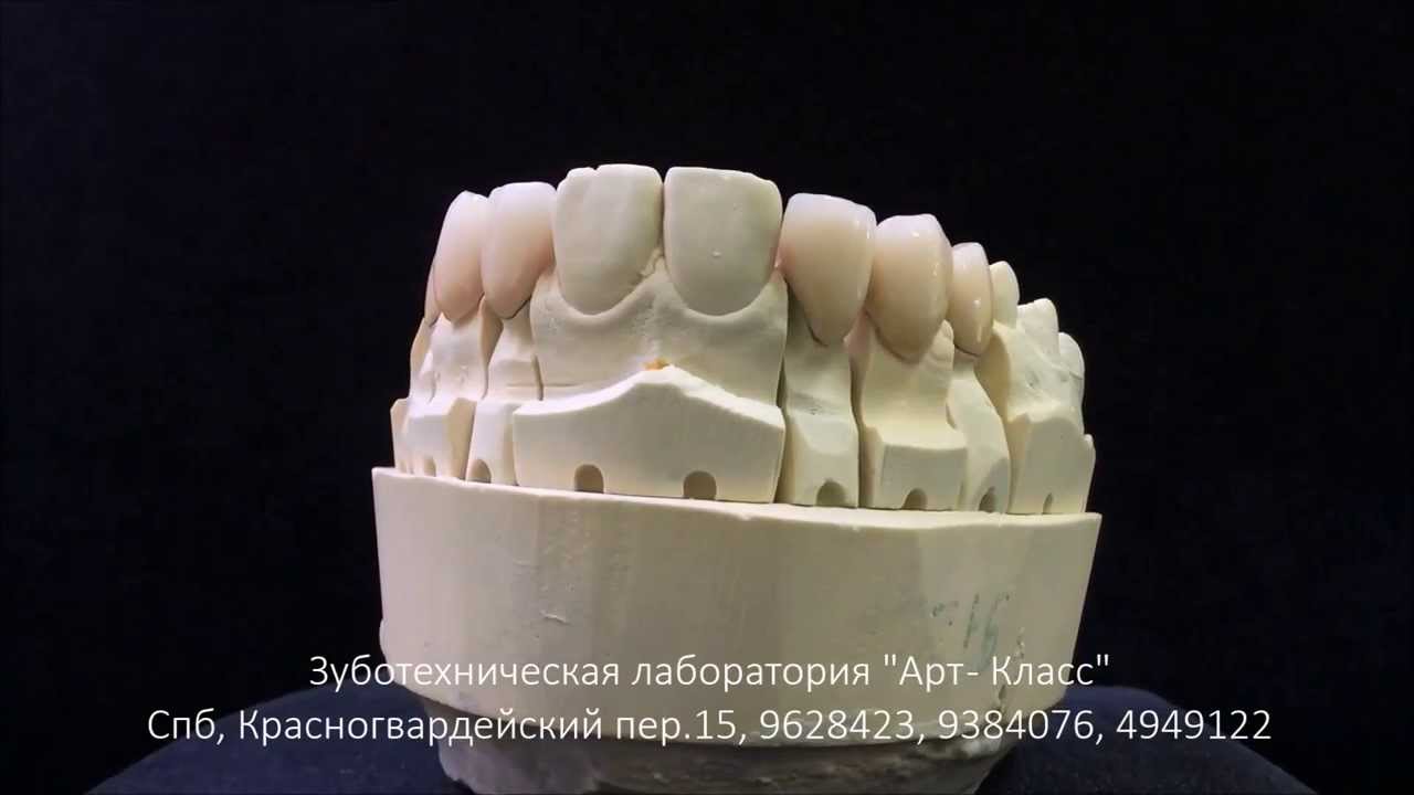 Металлокерамика для двигателя
