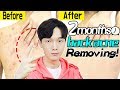 Back acne? Korean tips, solving it just in 2 months!