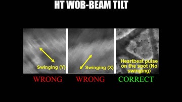 TEM Basic Alignment Tutorial