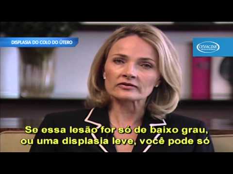 Vídeo: Eletroconização Do Colo Do útero Com Displasia: Tipos, Fases E Complicações