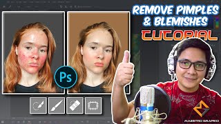 Adobe Photoshop How to Remove Pimples, Marks & Blemishes