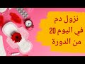 نزول دم في اليوم 20 من الدوره أسباب نزول دم بعد 20 يوم من الدورة هل نزول الدورة بعد 20 يوم طبيعي