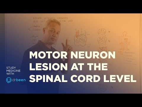 Motor Neuron Lesions