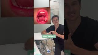 How Large Tonsils Affect Your Child Breathing