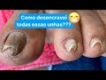 COMO DESENCRAVEI TODAS ESSAS UNHAS DE UMA SÓ VEZ?!😱😱