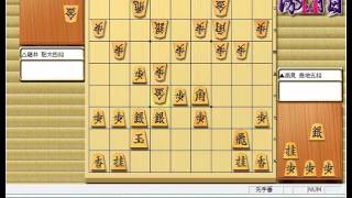 ★藤井聡太 順位戦★将棋 棋譜並べ ▲高見 泰地五段 vs △藤井 聡太四段 第76期順位戦C級2組3回戦 「技巧2」の棋譜解析 No.402 藤井聡太 検索動画18 ★藤井聡太 順位戦★将棋 棋譜並べ ▲高見 泰地五段 vs △藤井 聡太四段 第76期順位戦C級2組3回戦 「技巧2」の棋譜解析 No.402 藤井聡太 検索動画 18