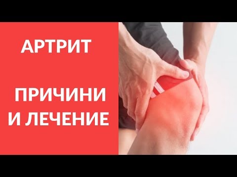 АРТРИТ - ПРИЧИНИ И ЛЕЧЕНИЕ