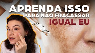 3 dicas infalíveis para cuidar do MELASMA EM CASA