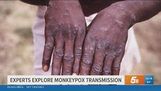 Experts explore monkeypox transmission