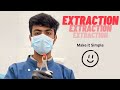 Extraction make it simple